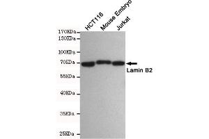 Western blot detection of Lamin B2 in HC, Mouse Embryo and Jurkat cell lysates using Lamin B2 mouse mAb(dilution 1:500). (Lamin B2 antibody)