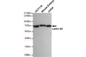 Western blot detection of Lamin B2 in HC, Mouse Embryo and Jurkat cell lysates using Lamin B2 mouse mAb(dilution 1:500).