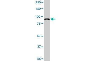 alpha Actinin 4 antibody  (AA 592-701)