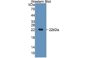 Figure. (GCDH antibody  (AA 270-438))
