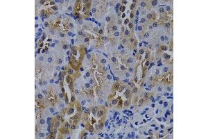 Immunohistochemistry of paraffin-embedded rat kidney using TNFRSF6B antibody at dilution of 1:200 (400x lens). (TNFRSF6B antibody)