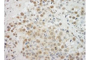 anti-Eyes Absent Homolog 4 (EYA4) (AA 100-150) antibody