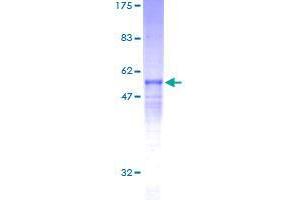 RCAN3 Protein (AA 1-241) (GST tag)