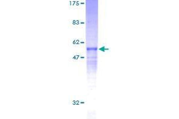 RCAN3 Protein (AA 1-241) (GST tag)