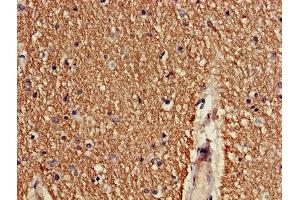 Immunohistochemistry of paraffin-embedded human brain tissue using ABIN7148482 at dilution of 1:100 (CNTNAP1 antibody  (AA 26-356))