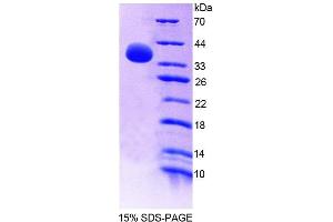 SDS-PAGE (SDS) image for Guanylate Binding Protein 4 (GBP4) (AA 1-292) protein (His tag) (ABIN4988854) (GBP4 Protein (AA 1-292) (His tag))