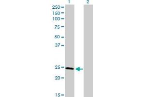 Western Blot analysis of RAD51L3 expression in transfected 293T cell line by RAD51L3 MaxPab polyclonal antibody. (RAD51D antibody  (AA 1-216))