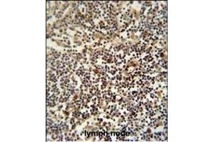 LTM5 antibody (N-term) 10077a immunohistochemistry analysis in formalin fixed and paraffin embedded human lymph node followed by peroxidase conjugation of the secondary antibody and DAB staining. (LAPTM5 antibody  (N-Term))
