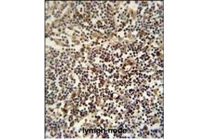 LTM5 antibody (N-term) 10077a immunohistochemistry analysis in formalin fixed and paraffin embedded human lymph node followed by peroxidase conjugation of the secondary antibody and DAB staining. (LAPTM5 antibody  (N-Term))