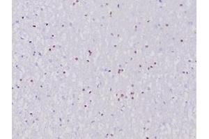 Immunohistochemistry (IHC) image for anti-Oligodendrocyte Lineage Transcription Factor 2 (OLIG2) (AA 200-300) antibody (ABIN7504157)