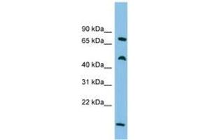 Image no. 1 for anti-Ecdysoneless Homolog (ECD) (C-Term) antibody (ABIN6744684)