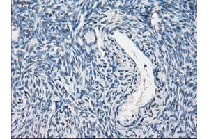 Immunohistochemical staining of paraffin-embedded colon tissue using anti-PPP5Cmouse monoclonal antibody.