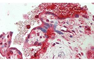Detection of ORM2 in Human Placenta Tissue using Polyclonal Antibody to Orosomucoid 2 (ORM2) (Orosomucoid 2 antibody)
