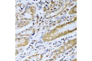 Immunohistochemical analysis of PSMB5 staining in human stomach formalin fixed paraffin embedded tissue section. (PSMB5 antibody)