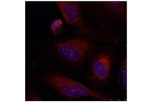 Image no. 2 for anti-Jun B Proto-Oncogene (JUNB) (AA 77-81) antibody (ABIN197139) (JunB antibody  (AA 77-81))