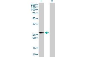 Western Blot analysis of RALB expression in transfected 293T cell line by RALB MaxPab polyclonal antibody.