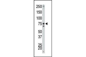 The anti-IKK alpha Pab (ABIN6243793 and ABIN6579033) is used in Western blot to detect IKK alpha in mouse spleen tissue lysate. (IKK alpha antibody)