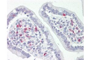 Human Small Intestine: Formalin-Fixed, Paraffin-Embedded (FFPE). (Scramblase antibody  (N-Term))