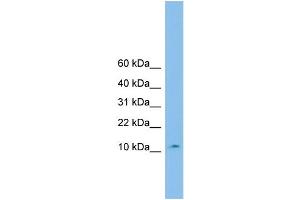 WB Suggested Anti-CHCHD1 Antibody Titration: 0. (CHCHD1 antibody  (Middle Region))