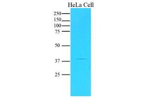 Western Blotting (WB) image for anti-serpin Peptidase Inhibitor, Clade B (Ovalbumin), Member 5 (SERPINB5) (AA 1-375), (N-Term) antibody (ABIN452659) (SERPINB5 antibody  (N-Term))