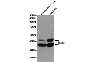 Western blot detection of SirT2 in Rat Cerebral Cortex and Rat Brain lysates using SirT2 mouse mAb (1:1000 diluted). (SIRT2 antibody)