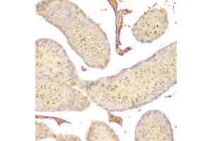 IHC analysis of GNAQ using anti GNAQ antibody (ABIN6719526).