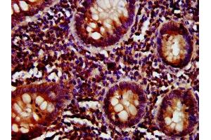 IHC image of ABIN7147144 diluted at 1:800 and staining in paraffin-embedded human appendix tissue performed on a Leica BondTM system. (CD27 antibody  (AA 20-191))
