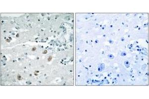 Immunohistochemistry analysis of paraffin-embedded human brain, using PLA2G4D Antibody. (PLA2G4D antibody  (AA 531-580))
