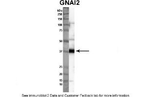 Sample Type: Nthy-ori cell lysate (50ug)Primary Dilution: 1:1000Secondary Antibody: anti-rabbit HRPSecondary Dilution: 1:2000Image Submitted By: Anonymous (GNAI2 antibody  (C-Term))