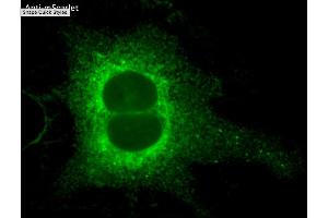 Immunofluorescence (IF) image for anti-mScarlet antibody (ABIN7273089) (mScarlet antibody)