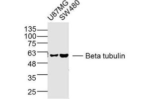 Lane 1: U87mg lysates Lane 2: SW480 lysates probed with Beta tubulin Polyclonal Antibody, Unconjugated  at 1:300 dilution and 4˚C overnight incubation.