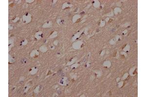 Immunohistochemistry (IHC) image for anti-FYN Oncogene Related To SRC, FGR, YES (FYN) antibody (ABIN7127505)