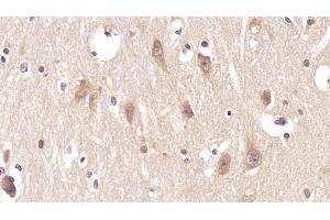 Immunohistochemistry (IHC) image for anti-Parathyroid Hormone 2 Receptor (PTH2R) (AA 27-145) antibody (ABIN7425878)