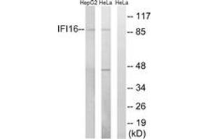 Western blot analysis of extracts from HeLa/HepG2 cells, using IFI16 Antibody. (IFI16 antibody  (AA 731-780))