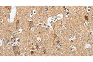 Immunohistochemistry of paraffin-embedded Human brain using DSCR1 Polyclonal Antibody at dilution of 1:45 (RCAN1 antibody)