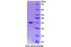 SDS-PAGE (SDS) image for Interleukin 18 (IL18) (AA 37-193) protein (His tag) (ABIN2125464) (IL-18 Protein (AA 37-193) (His tag))