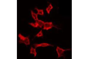 ABIN6272251 staining COLO205 by IF/ICC. (ARRDC4 antibody  (Internal Region))