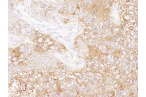 Immunohistochemistry (IHC) image for anti-Eukaryotic Translation Elongation Factor 2 (EEF2) (AA 808-858) antibody (ABIN7448956) (EEF2 antibody  (AA 808-858))