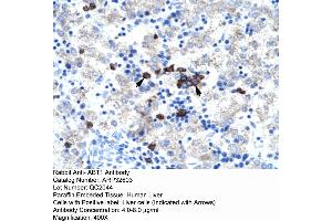 Human kidney (Activator of Basal Transcription 1 antibody  (Middle Region))