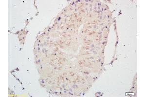 Formalin-fixed and paraffin embedded rat testis labeled with Rabbit Anti PSCA Polyclonal Antibody, Unconjugated (ABIN671676) at 1:200 followed by conjugation to the secondary antibody and DAB staining (PSCA antibody  (AA 24-123))