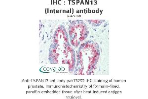 Image no. 1 for anti-Tetraspanin 13 (TSPAN13) (Internal Region) antibody (ABIN1740424) (TSPAN13 antibody  (Internal Region))