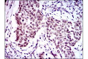 Image no. 1 for anti-Forkhead Box P1 (FOXP1) antibody (ABIN1491561) (FOXP1 antibody)