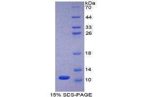 SDS-PAGE (SDS) image for Peptidase Inhibitor 3, Skin-Derived (PI3) (AA 41-117) protein (His tag) (ABIN1080484)