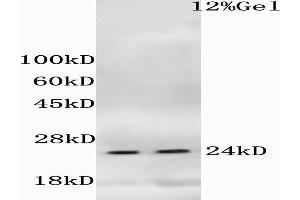 L1 mouse liver, L2 mouse cerebrum lysates probed (ABIN685183) at 1:200 in 4 °C. (HIST1H1E antibody  (pThr18))