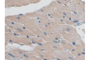 Immunohistochemistry (IHC) image for anti-Mitogen-Activated Protein Kinase Kinase Kinase 5 (MAP3K5) (AA 693-933) antibody (ABIN1858085)