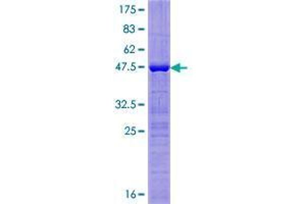 BTF3L4 Protein (AA 1-158) (GST tag)