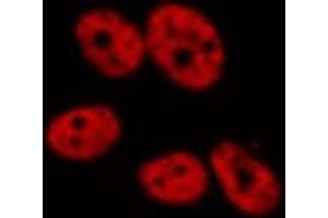 ABIN6277771 staining HeLa by IF/ICC. (CSNK2A1/CK II alpha antibody  (N-Term))