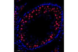 Immunofluorescence of paraffin embedded rat testis using QSK (ABIN7075608) at dilution of 1:600 (300x lens) (SIK3 antibody)