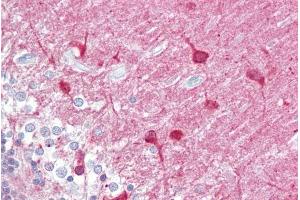 Immunohistochemistry (IHC) image for anti-Protein Kinase C and Casein Kinase Substrate in Neurons 1 (PACSIN1) (N-Term) antibody (ABIN184665)