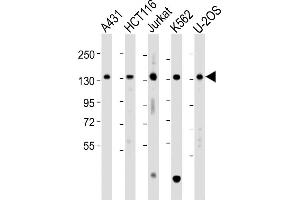 All lanes : Anti-TACC3 Antibody (Center) at 1:2000 dilution Lane 1: A431 whole cell lysate Lane 2: HC whole cell lysate Lane 3: Jurkat whole cell lysate Lane 4: K562 whole cell lysate Lane 5: U-2OS whole cell lysate Lysates/proteins at 20 μg per lane. (TACC3 antibody  (AA 317-350))